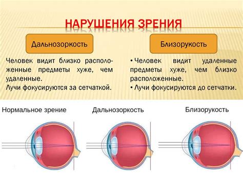 Исчезновение дефектов зрения