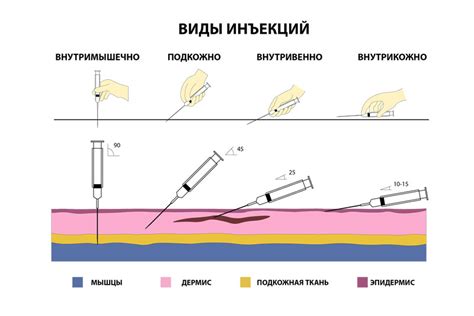 Какие препараты можно вводить инфузионным методом