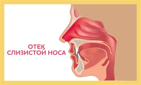 Как вернуть здоровье слизистой носа