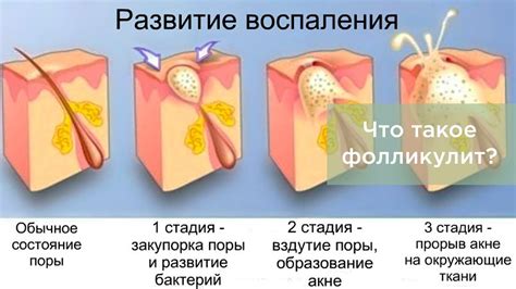 Как воздействует процедура на фолликулы