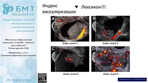 Как выглядят различные образования на уЗИ