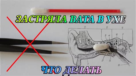 Как избавиться от эха в ухе