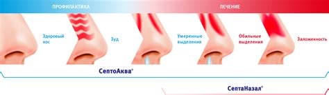 Как можно лечить заложенность носа