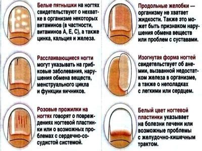 Как понять состояние организма по ногтям