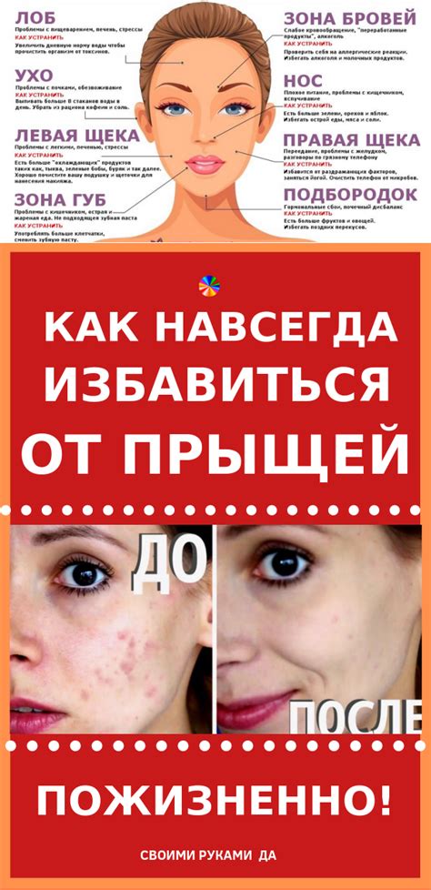 Как правильно выбирать косметологические процедуры в период приема антибиотиков