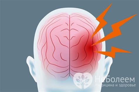 Как предупредить кровоизлияние в мозг у новорожденных