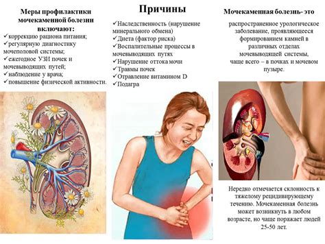Калина и мочекаменная болезнь