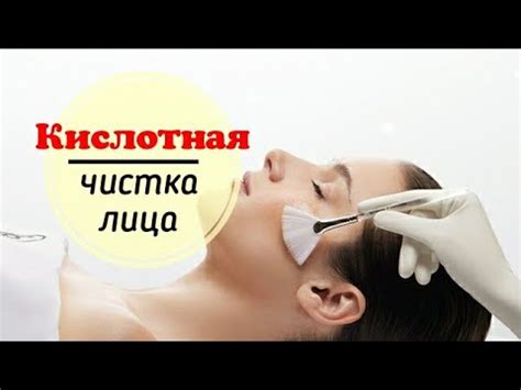 Кислотная чистка