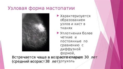 Кистозная мастопатия и уплотнения