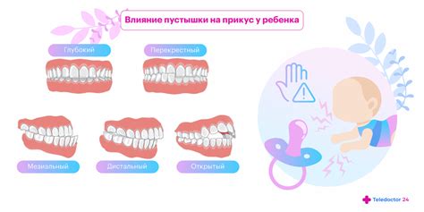 Когда использование пустышки необходимо