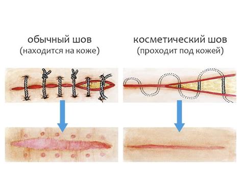 Когда проводить швы