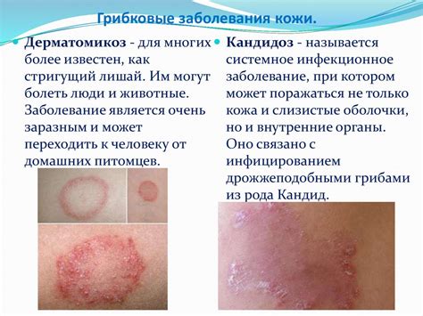 Кожные инфекции и их влияние