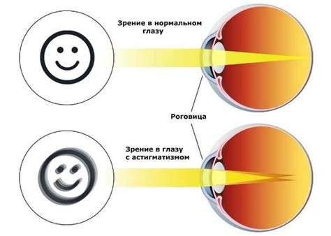 Комплексный подход к улучшению зрения у людей с высокой степенью близорукости