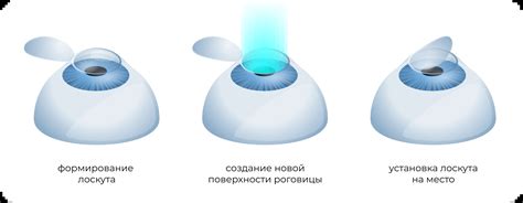 Лазерная коррекция зрения: риски и вероятность ослепления