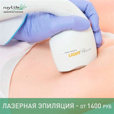 Лазерная эпиляция как эффективный способ устранения волос