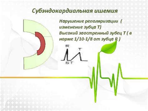 Лекарственные препараты, вызывающие нарушения реполяризации миокарда