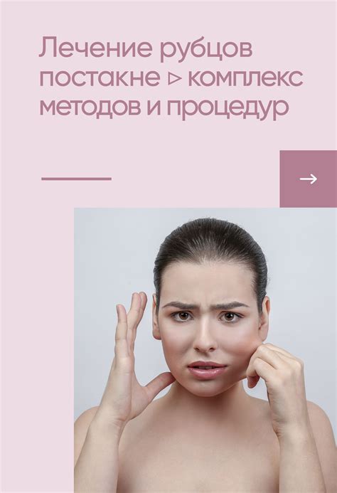 Лечение арахноидальных изменений