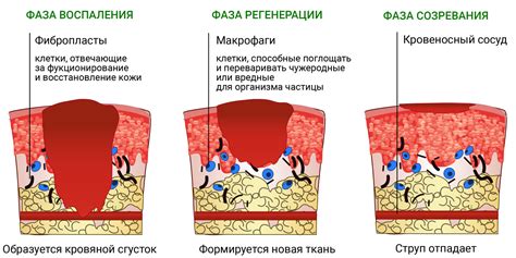 Лечение ожога и формирование новой розовой кожи