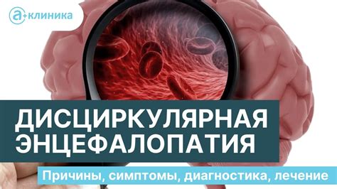 Лечение органического расстройства смешанного генеза