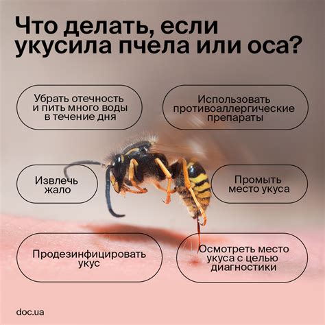 Лечение укуса осы в голову