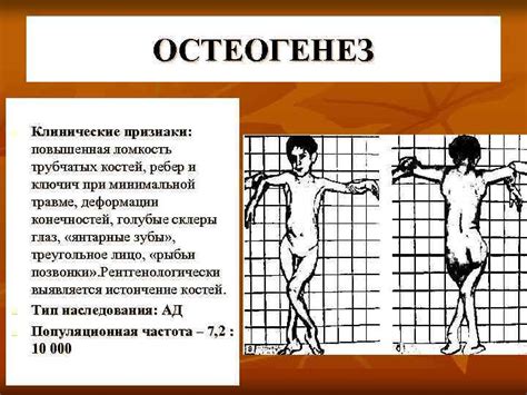 Ломкость костей