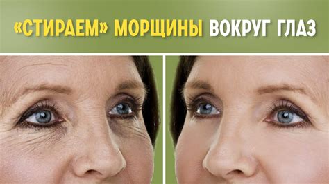 Маринование гусиных лапок