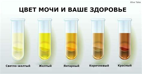 Медицинские факторы, связанные с появлением оранжевой мочи: что может говорить о заболеваниях