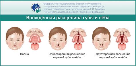 Меры предосторожности при опухании верхней губы и десен