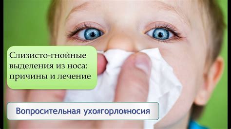 Механизмы и причины продолжения выделения слизи из носа