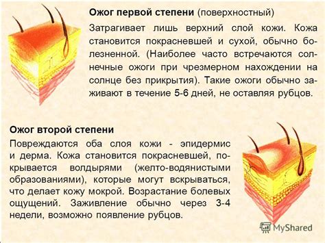Механизм развития ожога