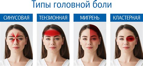 Мигрень или головная боль
