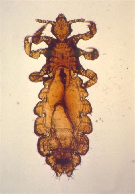 Морфологические особенности вши: головные и лобковые формы