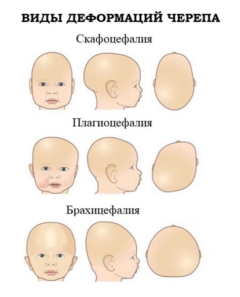 Наблюдайте за состоянием ребенка и проведите осмотр черепа