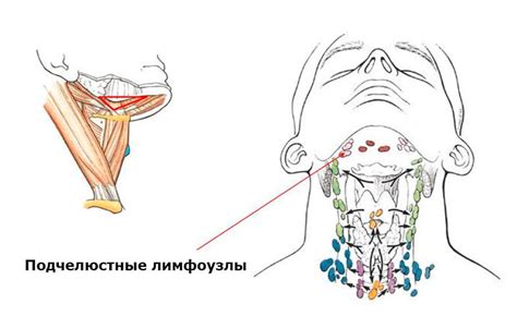 Нагревание воспаленных лимфоузлов под челюстью: эффективные методы