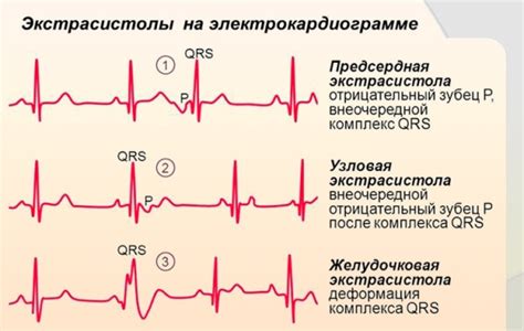 Назначение ЭКГ у разных пациентов: роль возраста и состояния здоровья