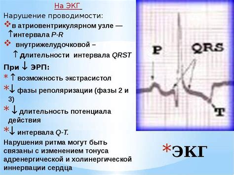 Нарушение внутрижелудочковой проводимости на электрокардиограмме