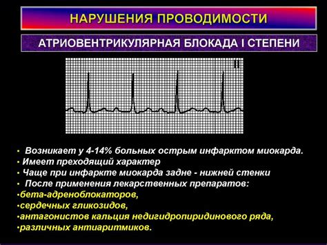 Нарушение предсердной проводимости на ЭКГ