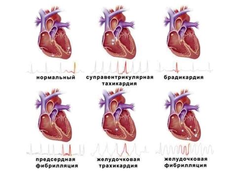 Нарушение рабочего ритма и дисциплины