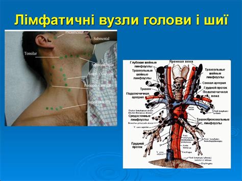 Научные советы от экспертов: как помочь себе при росте лимфоузлов на шее