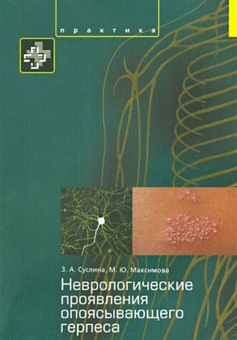 Неврологические проявления: