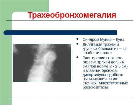 Недостаточное развитие хрящей