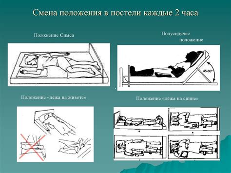 Неправильное расположение креплений