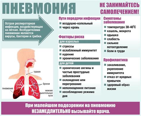 Новое лекарство для пневмонии: находка с потенциальными перспективами