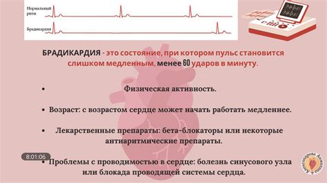 Нормализация работы сердечного ритма