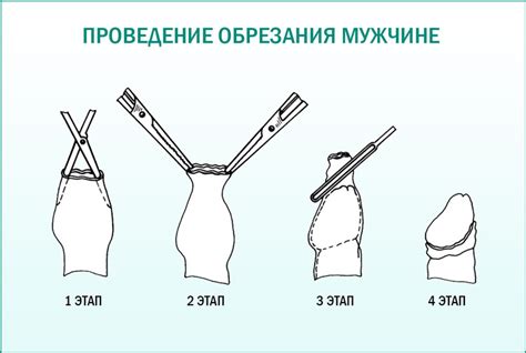 Обязательность обрезания по Корану
