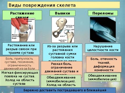 Ограниченность движений