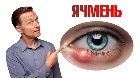 Опасность мошки в глазу: что делать