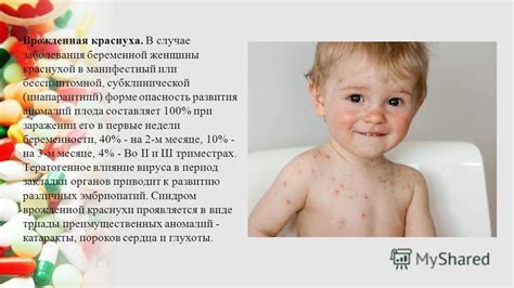 Опасность реинфекции вирусом краснухи