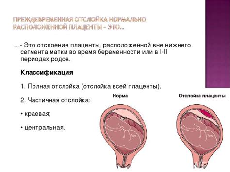 Описание плаценты 2 степени