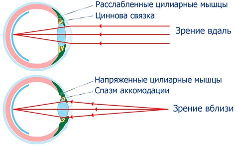 Оптические методы коррекции для пациентов с нарушением аккомодации глаза